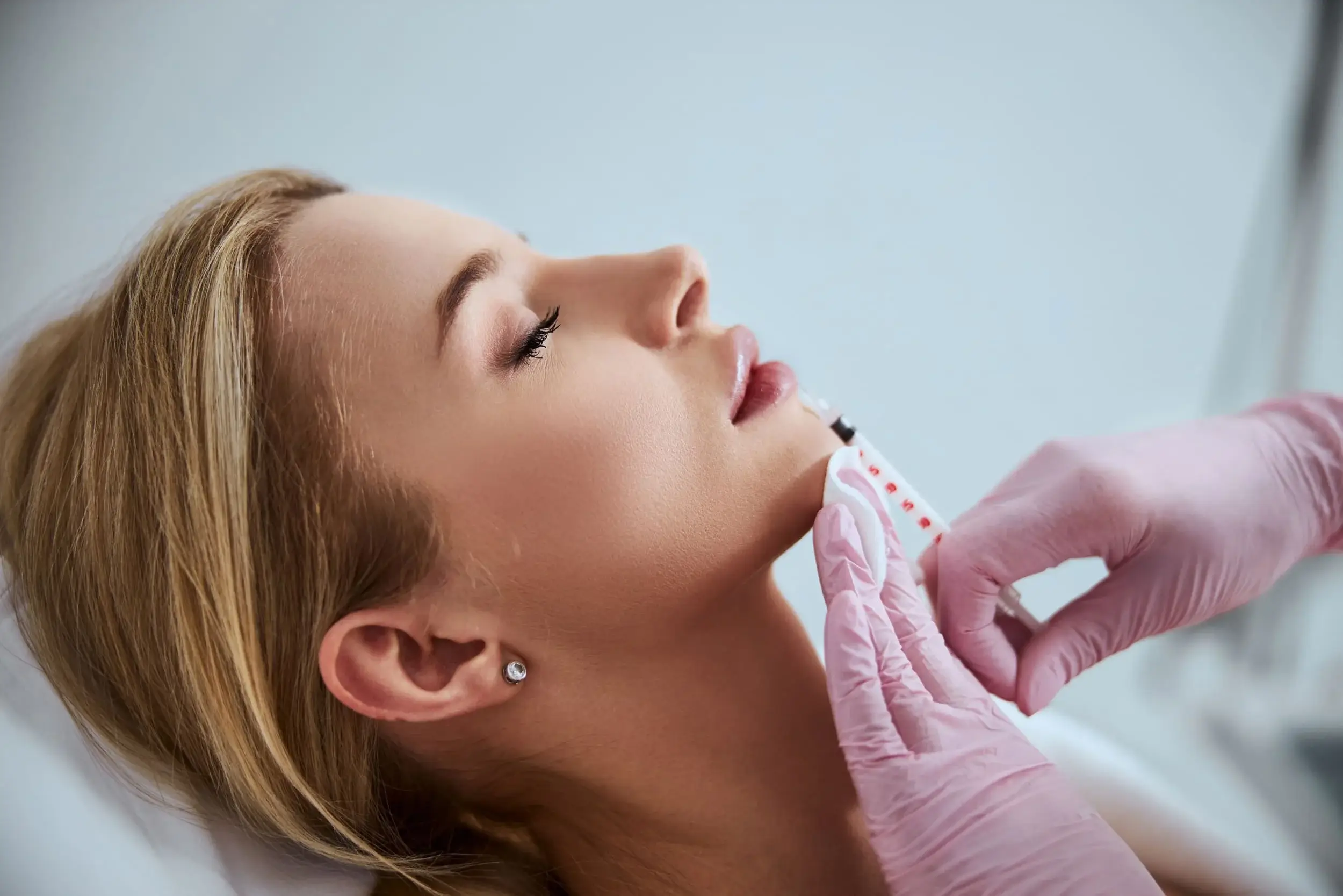 Dermal Fillers in Chandler AZ - Opulent Aura Aesthetics LLC