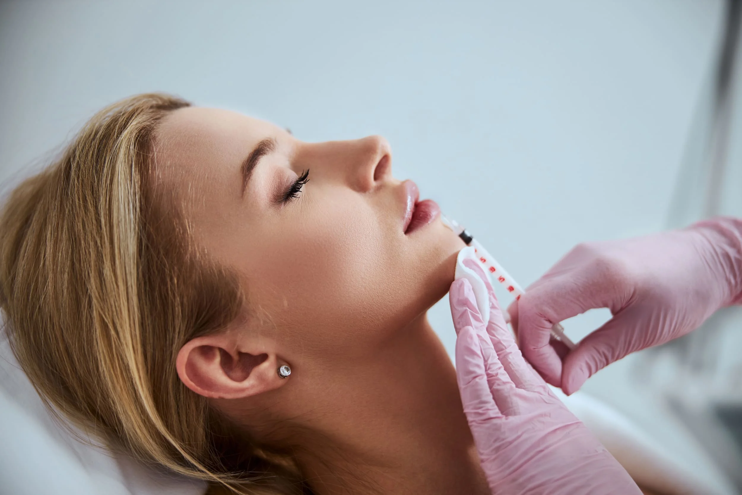 dermal-fillers | Chandler, AZ | Opulent Aura Aesthetics LL